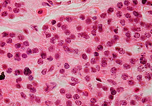 histologia - przytarczyce Komórki główne i komórki oksyfilne1.jpg